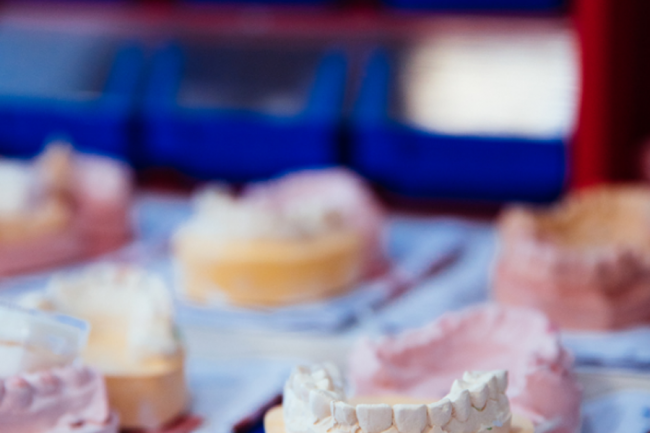 Dental Implant in Abui Dhabi