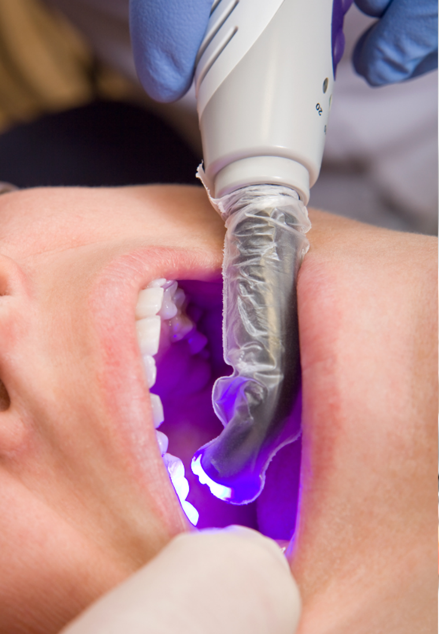 Dental filling in Abu Dhabi