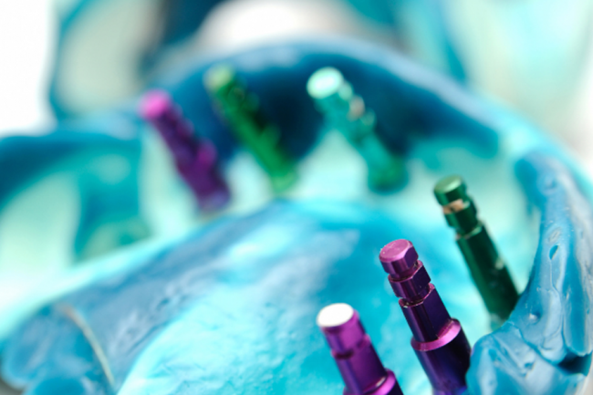 Dental Implant in Abui Dhabi