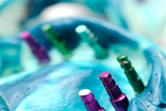 Dental Implant in Abui Dhabi