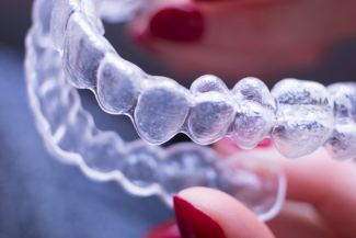 invisalign in Abu Dhabi