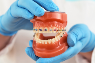 orthodontics treatment in Abu Dhabi