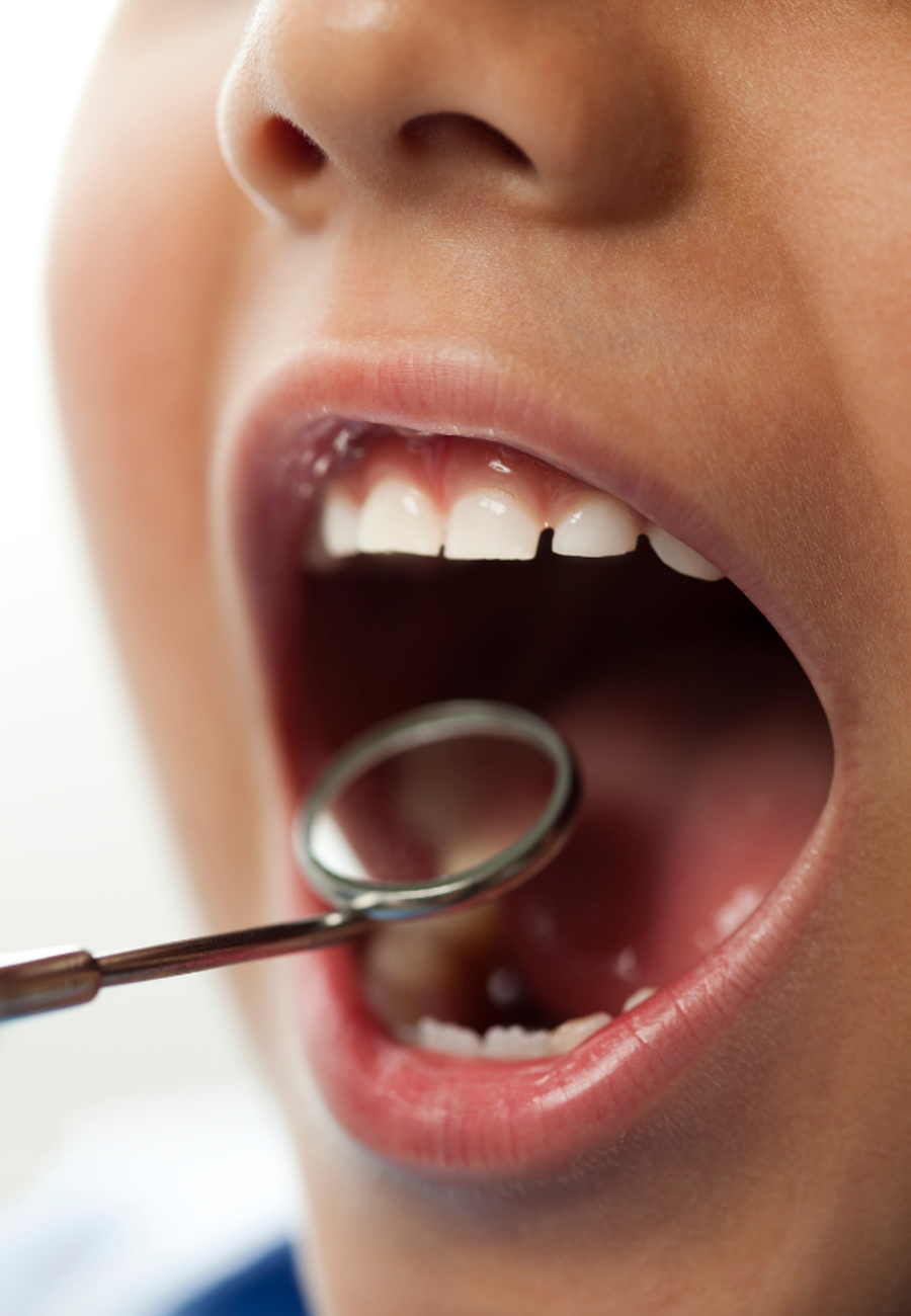 pediatric dentistry in Abu Dhabi