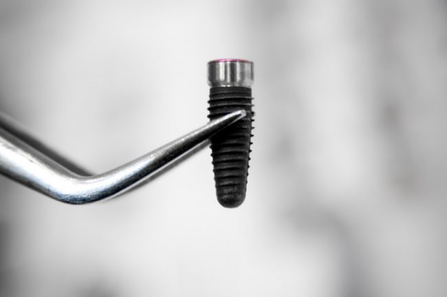 Dental Implant in Abui Dhabi